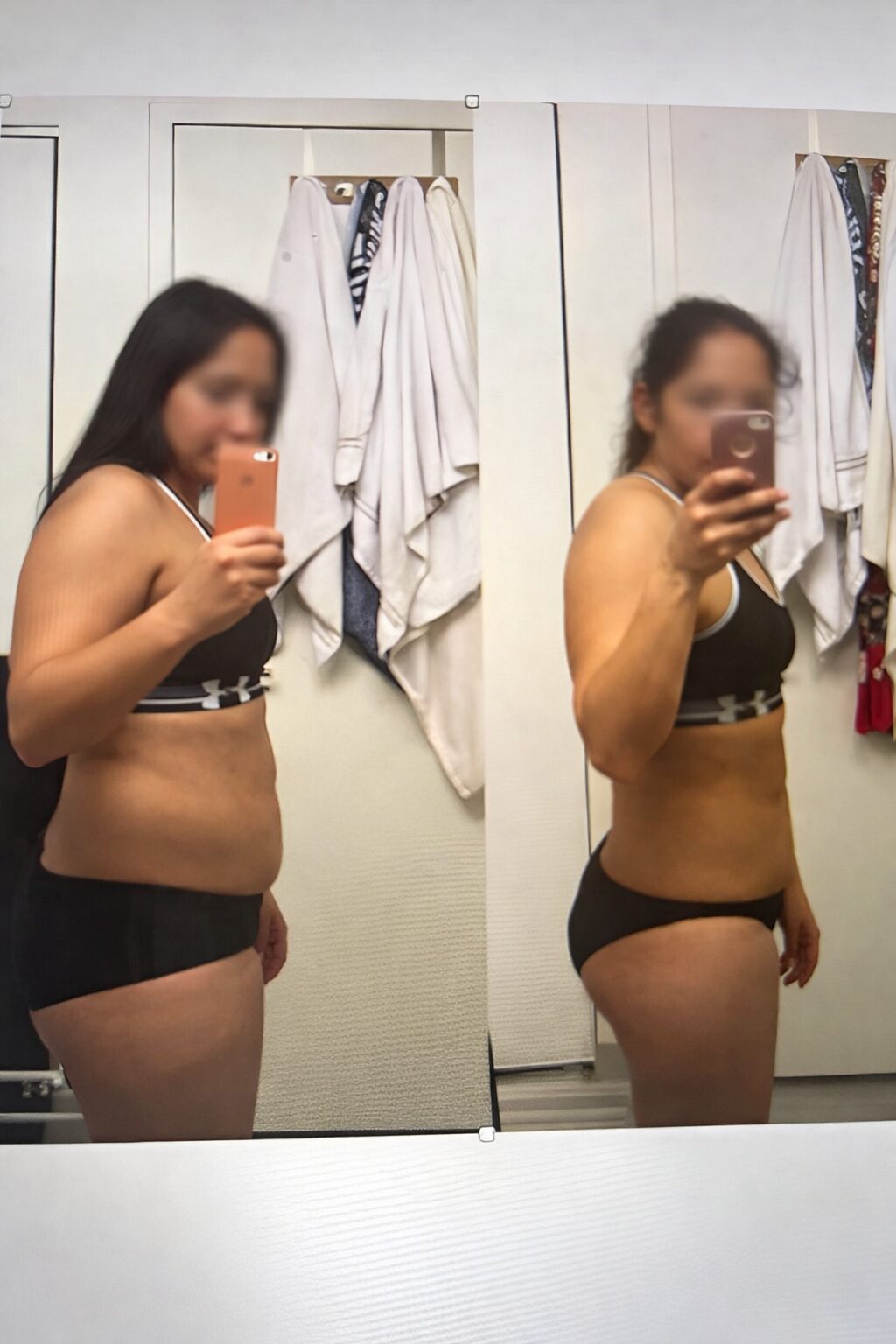 Before and after weight loss transformation of a woman in black underwear.