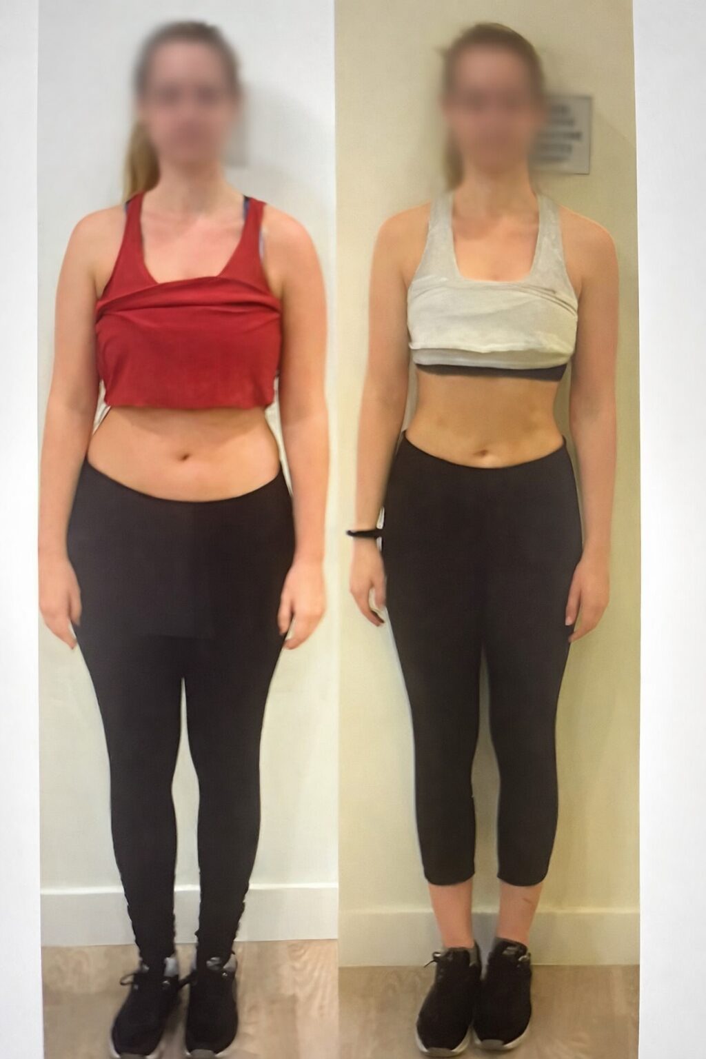Before and after weight loss transformation of a woman.